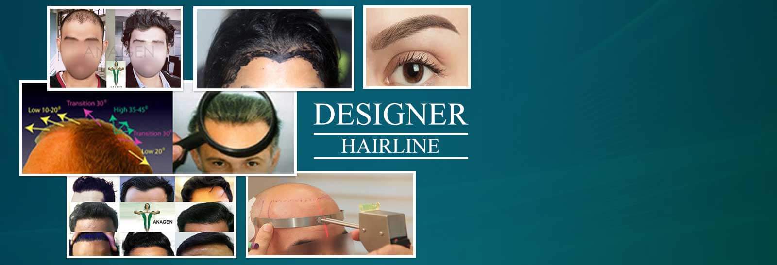 Designer Hairline