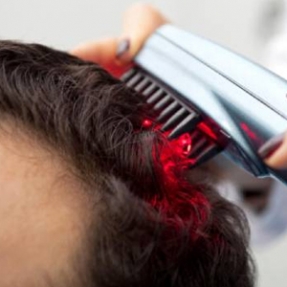 Laser Hair Therapy in Mumbai 